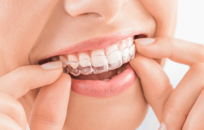 can invisalign fix severe misalignment